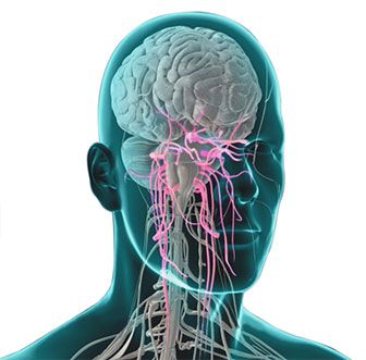 trigeminal-neuralgia